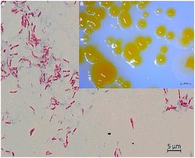 Description of Mycobacterium pinniadriaticum sp. nov., isolated from a noble pen shell (Pinna nobilis) population in Croatia